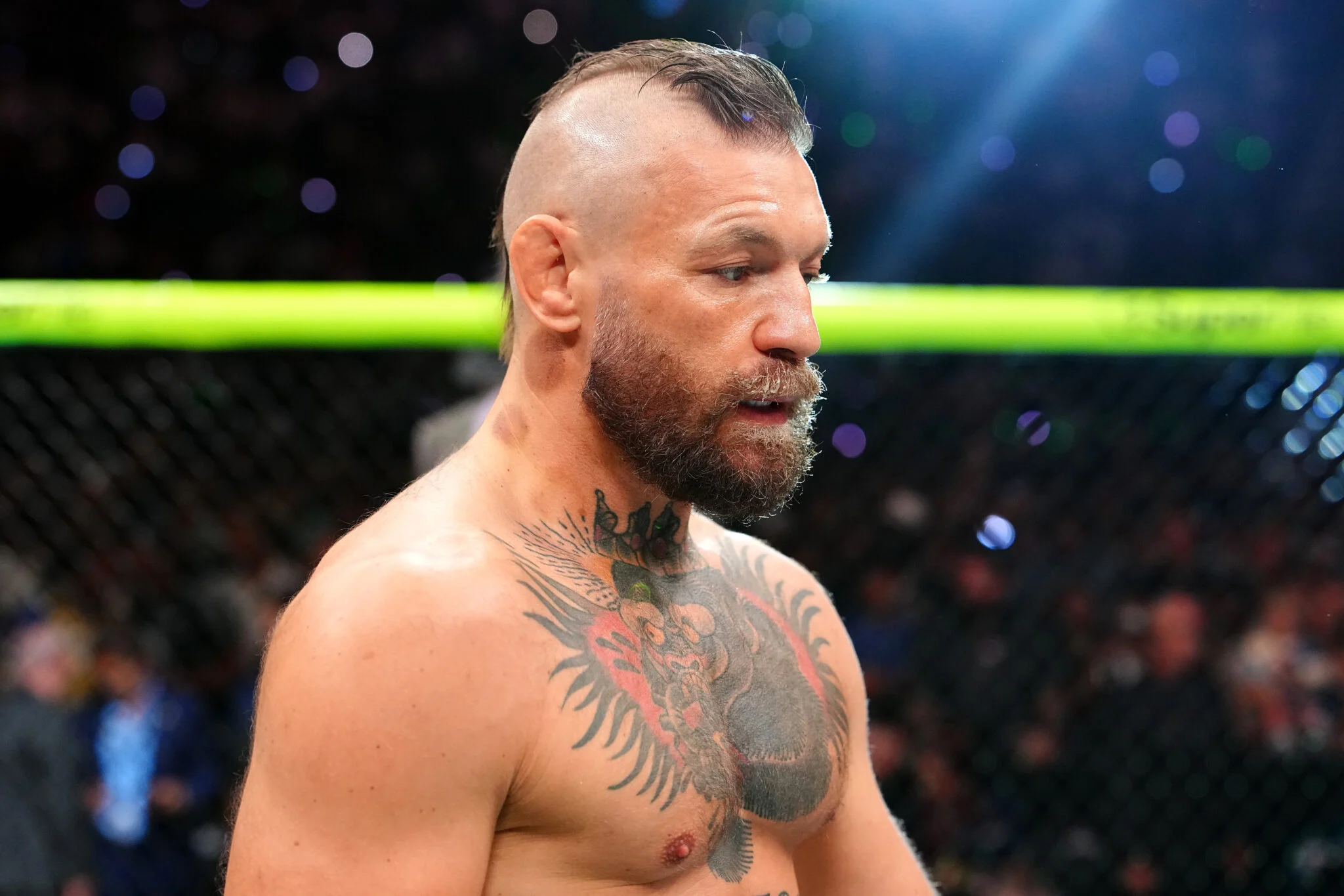Conor McGregor revela extensão de grave lesão no joelho do UFC 329 e surpreende ao dizer que foi ‘salvo de algo pior’