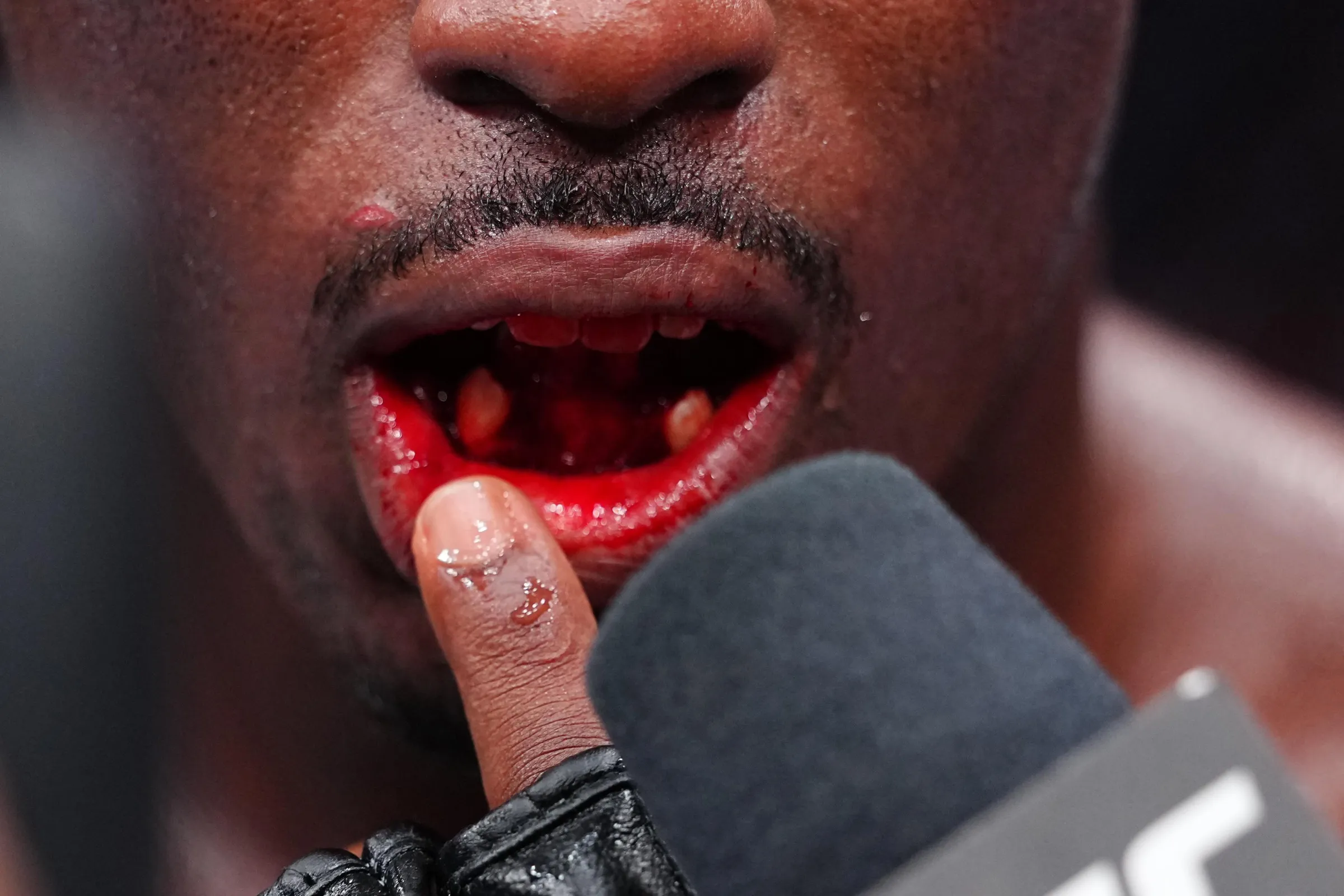 Vitória de Tresean Gore no UFC 330 tem desfecho inesperado: lutador é levado ao hospital com dentes quebrados após joelhada de Luque