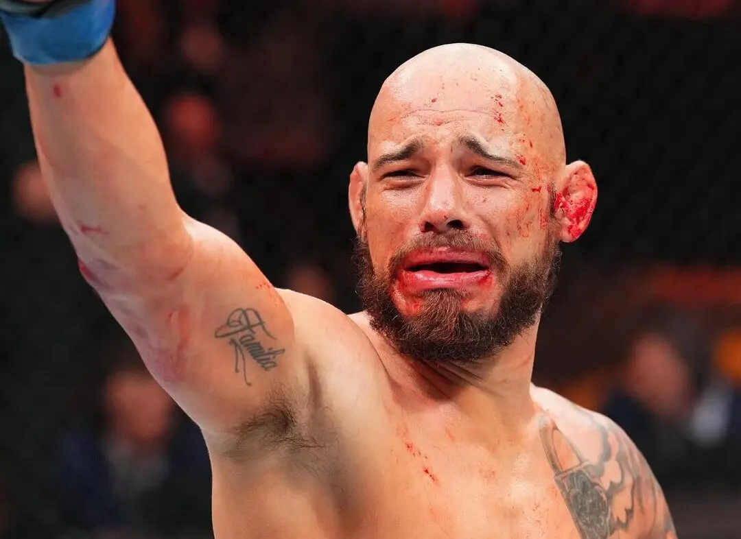 Jean Silva ‘Nerd’ Revela Chocantes Lesões e Cortes Sofridos em Camp para o Noche UFC Contra José Miguel Delgado, Aumentando a Expectativa para a Luta Principal